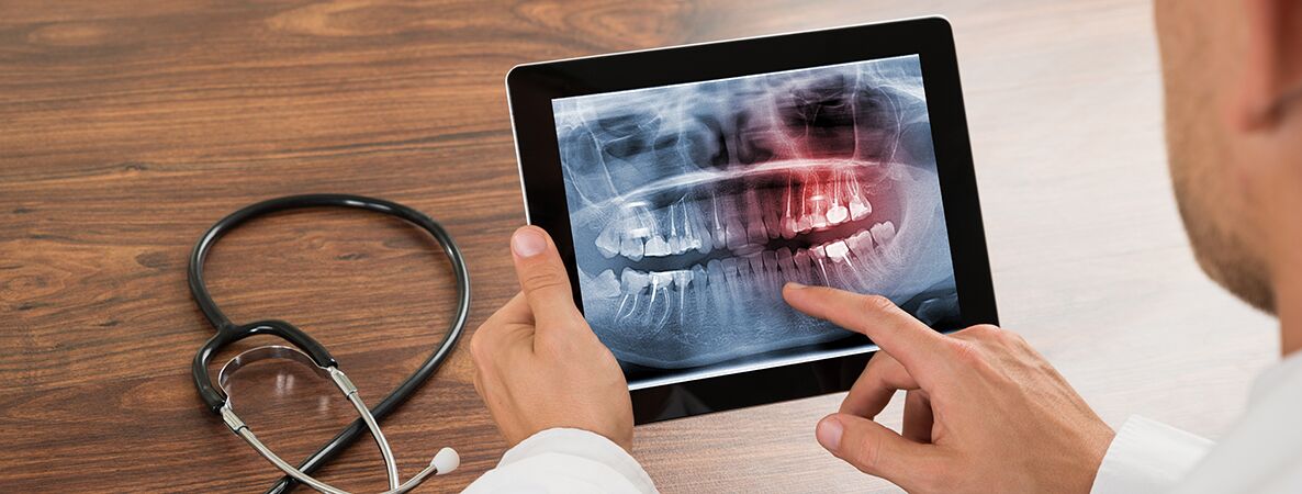 Digitales Röntgen bei Dr. Dude, Zahnarzt in Bad Homburg